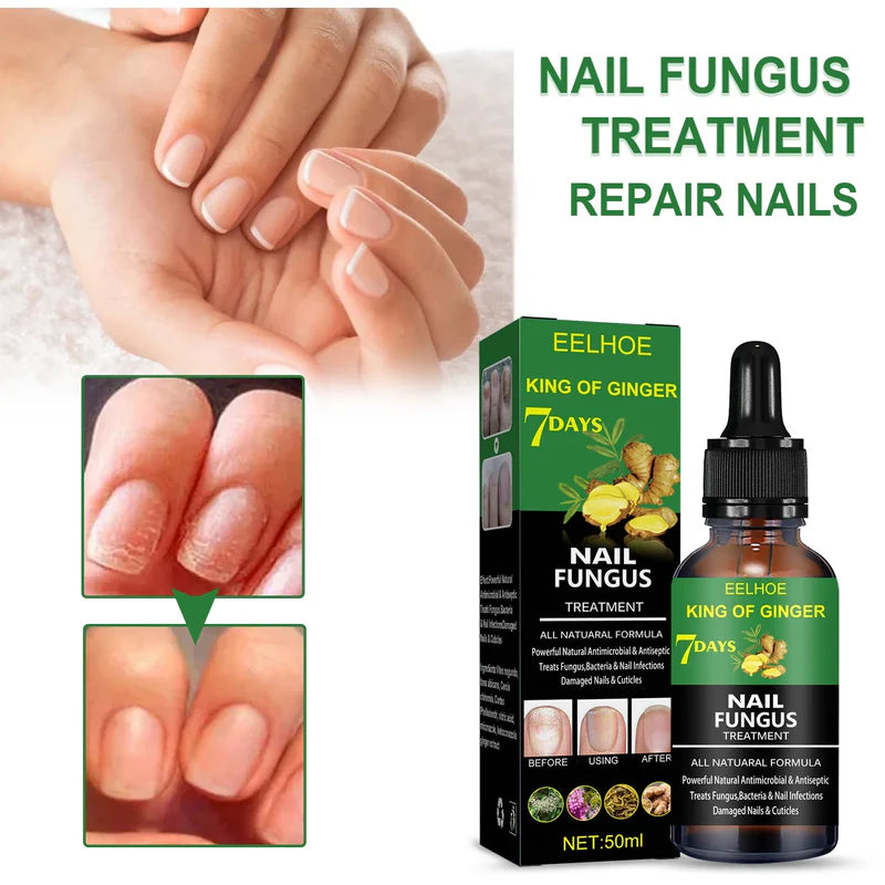 Fortalecedor de uñas 7 Days - ¡Uñas más fuertes y crecimiento más rápido!
